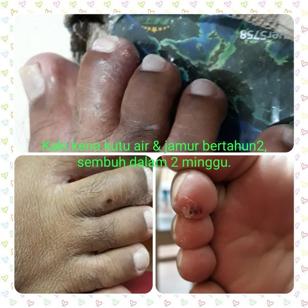 testimoni biosaver 5758 (5)