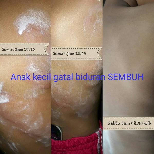 testimoni biosaver 5758 (7)